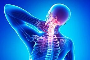 El dolor de espalda como síntoma de osteocondrosis. 