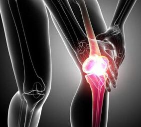 Dolor de rodilla en artritis y osteoartritis. 