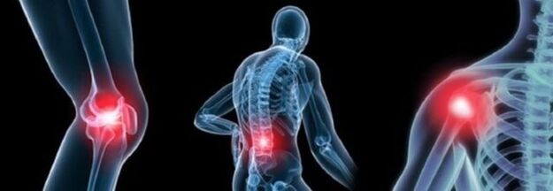 Tipos de dolor con osteoartritis