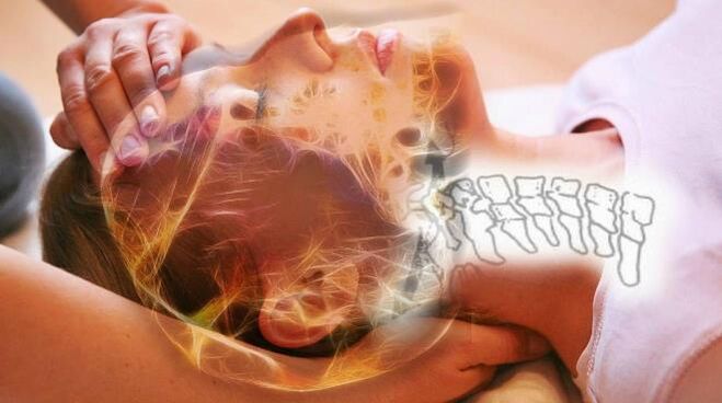Cambios degenerativos en las rodajas vertebrales para la osteocondrosis cervical