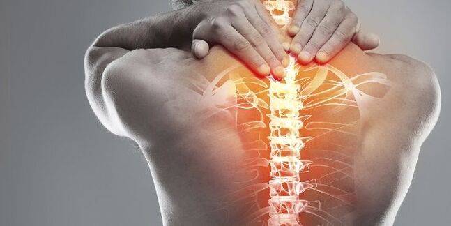 Opciones médicas para la terapia de cuello uterino de la osteocondrosis cervical
