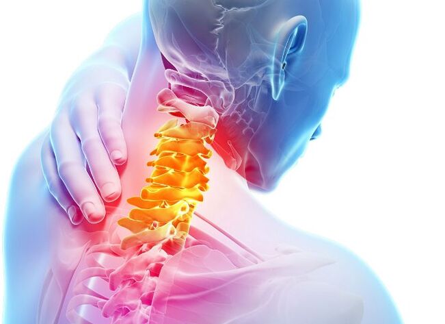 Síntomas y etapas del desarrollo de la osteocondrosis cervical