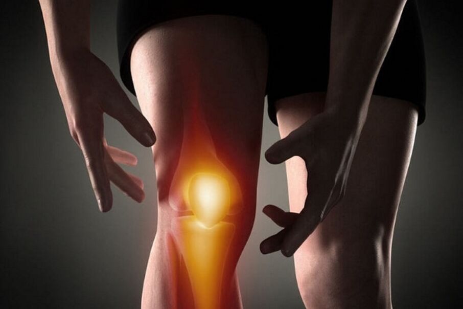 En la osteoartritis, el dolor aumenta con el movimiento.